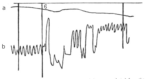 ecg