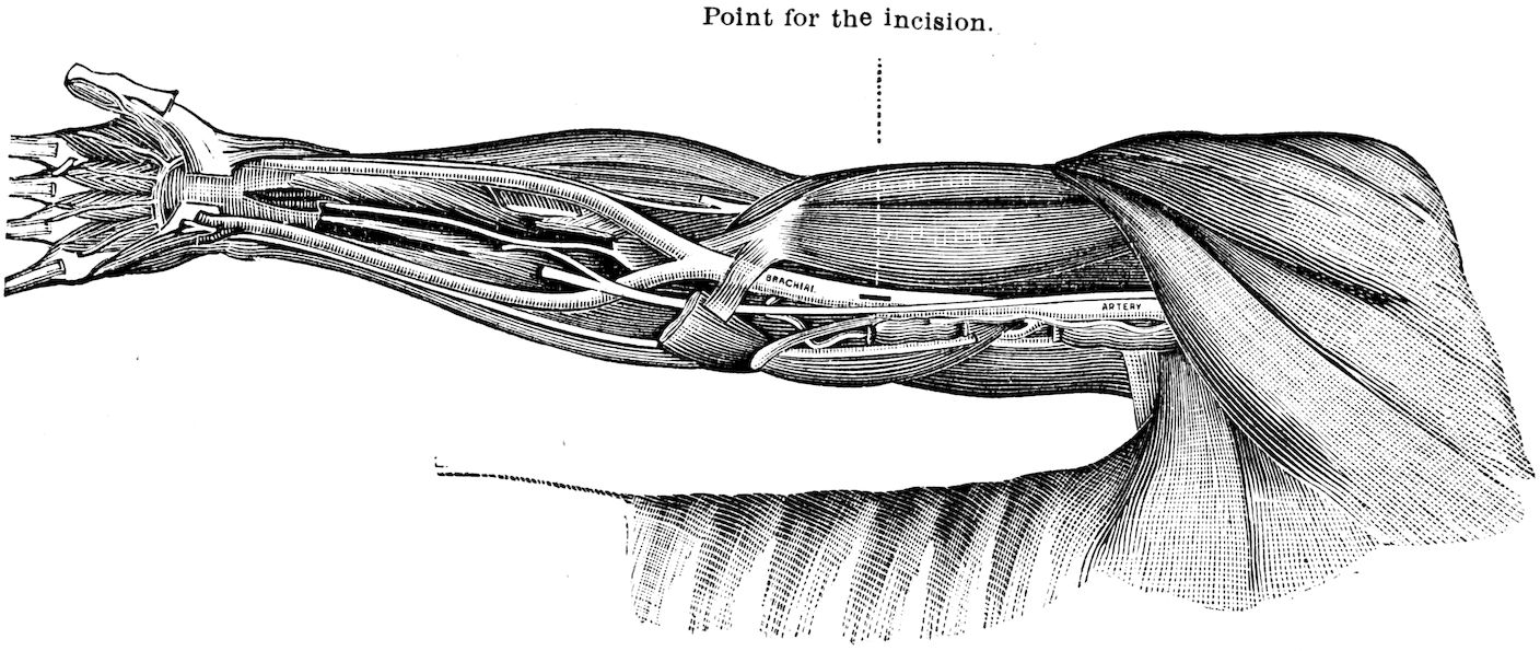 Point for the incision.