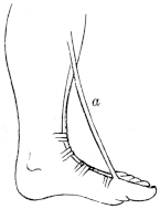 Shows ligaments restraining tendons on front of ankle