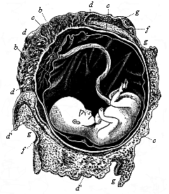 Fig.199. Human foetus, twelve weeks old, with its membranes.