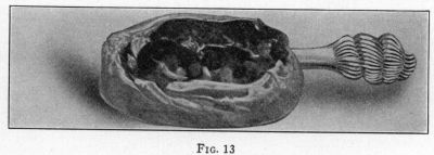 [Illustration: FIG. 13]