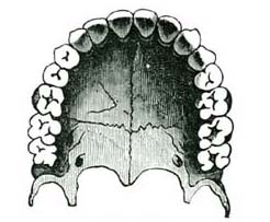 THE TEETH.