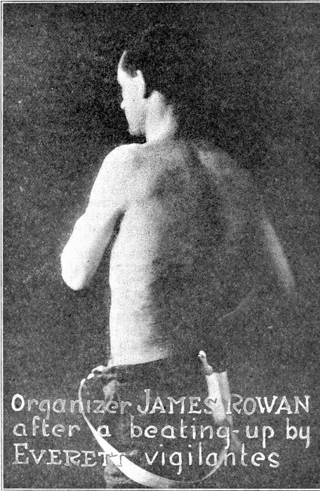 Organizer James Rowan;
Showing his back lacerated by Lumber Trust thugs.
