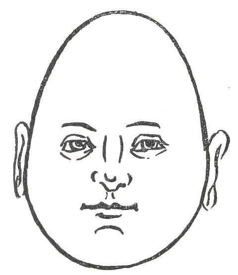 Fig. 17

INVERTED EGG-SHAPED FACE